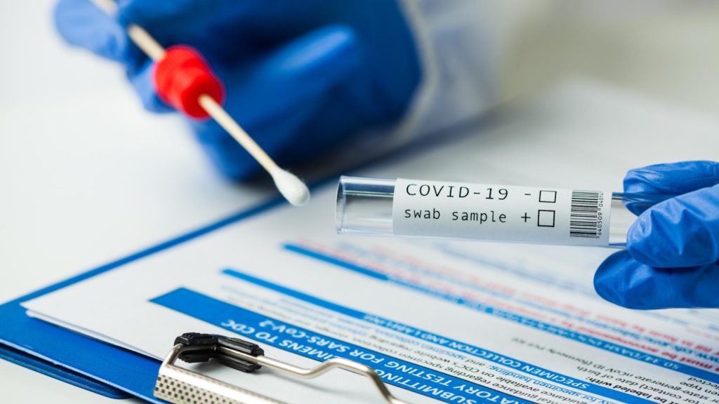 PCR and Rapid Antigen COVID tests